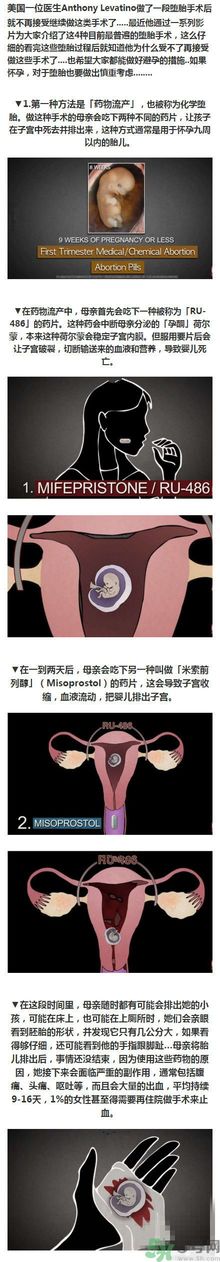 墮胎手術(shù)的可怕細節(jié)