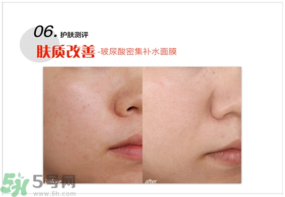 home facialpro玻尿酸密集補水面膜怎么樣與使用方法