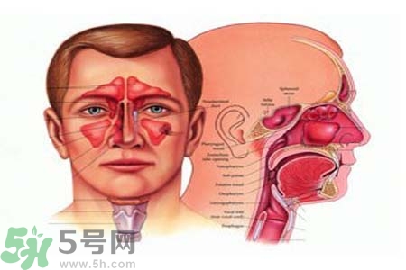 鼻竇炎是什么？鼻竇炎的癥狀有哪些？