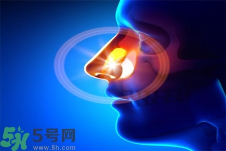 鼻竇炎的高發(fā)人群？如何預(yù)防鼻竇炎？