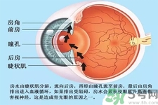 青光眼是什么？青光眼癥狀有什么？