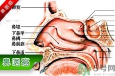 鼻咽癌是什么？鼻咽癌的癥狀有哪些？