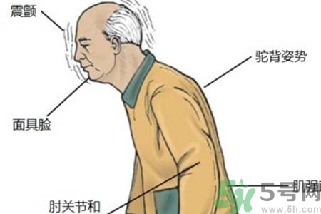 帕金森的易發(fā)人群有哪些？如何預(yù)防帕金森？