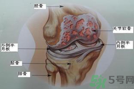 預(yù)防骨病需要注意哪些姿勢(shì)？秋季預(yù)防骨病的方法有哪些？