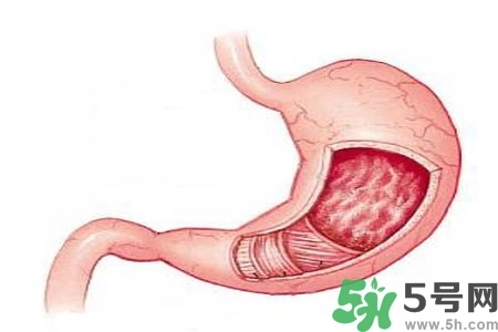 急性腸胃炎哪些食物不可以吃？急性腸胃炎不能吃的水果有？