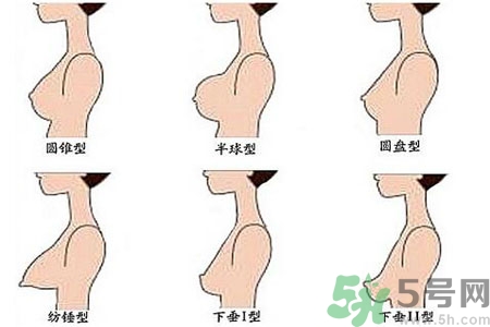 ?女性乳房下垂的原因是什么？女性乳房下垂的分類有哪些？