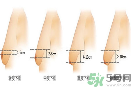 胸部松弛的原因是什么？胸部松弛該怎么辦？