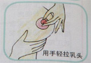 乳頭內(nèi)陷怎么回事？乳頭內(nèi)陷的原因是什么？