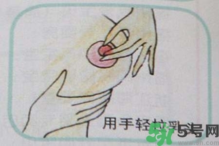 乳頭內(nèi)陷怎么矯正？乳頭內(nèi)陷矯正方法是什么？