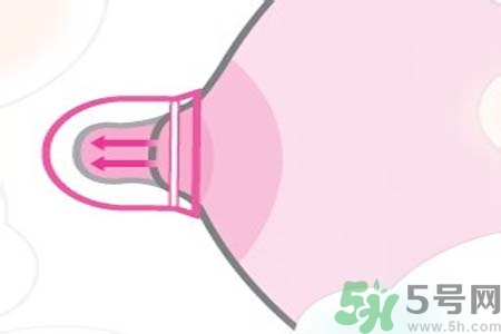 乳頭內(nèi)陷能不能喂奶？乳頭凹陷怎樣哺乳？