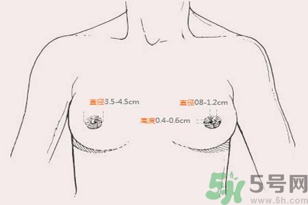 乳頭內(nèi)陷能不能喂奶？乳頭凹陷怎樣哺乳？