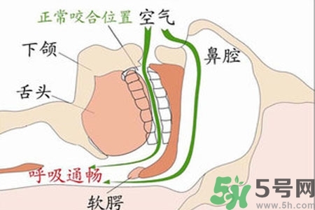 鼻子紅是什么原因？鼻子紅怎么辦？