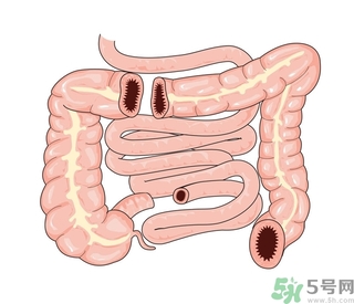 腸炎肚子疼怎么辦？腸炎肚子疼怎么緩解？