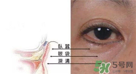 淚溝是怎么形成的?淚溝和眼袋的區(qū)別