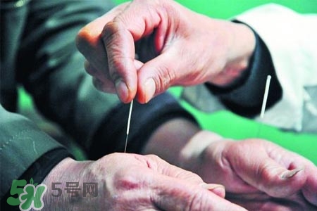 沒病可以針灸嗎？沒病可以扎針嗎？