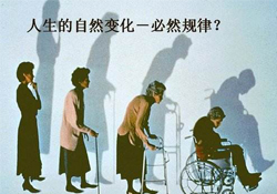 哪些人容易得骨質(zhì)疏松癥？骨質(zhì)疏松的高發(fā)人群有哪些？