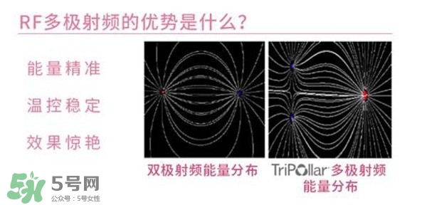 tripollar stop怎么樣？tripollar pose好用嗎