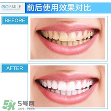 gosmile牙齒美白劑好用嗎?gosmile牙齒美白劑怎么樣?