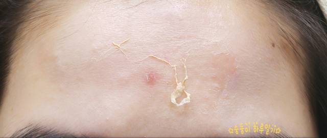 real skin patch怎么樣？real skin是什么牌子