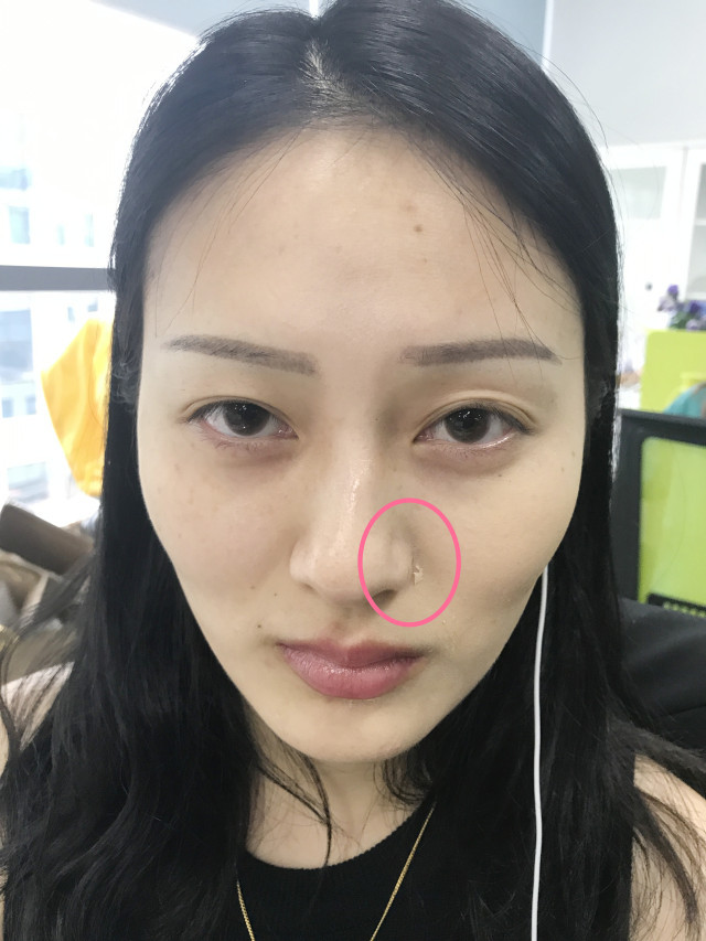 real skin patch怎么樣？real skin是什么牌子