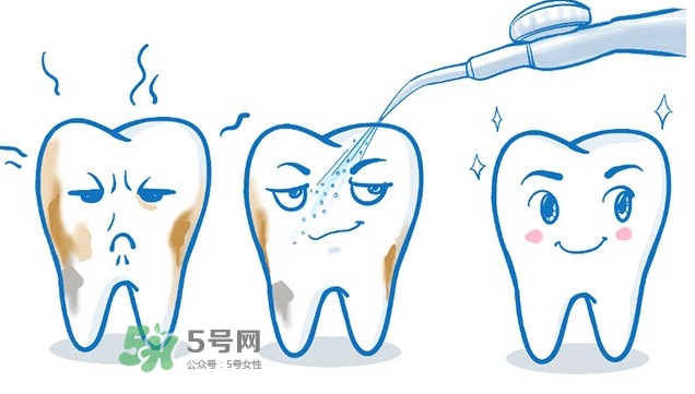 洗牙多少錢(qián)一次 洗牙多久洗一次比較好