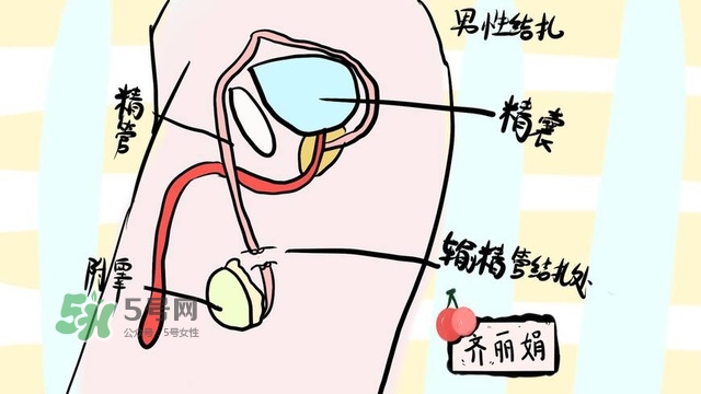 生完二胎一定要結(jié)扎嗎？生完二胎結(jié)扎好不好？