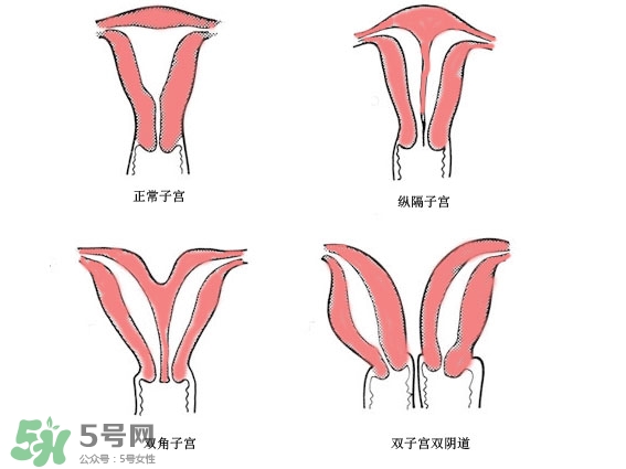 雙子宮是什么意思？雙子宮可以順產(chǎn)嗎？