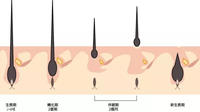 頭發(fā)為什么會(huì)掉？毛囊想休息了