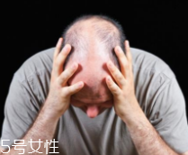 脫發(fā)有沒(méi)有治？只要不是禿子就有得治