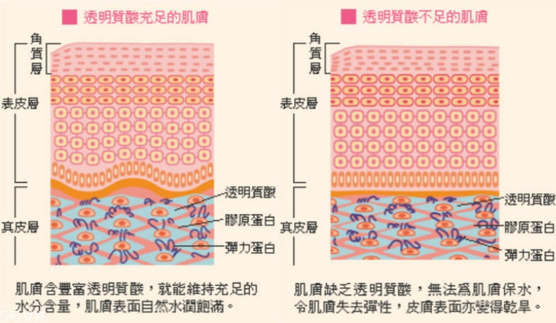 干性肌膚怎么抗皺 干性肌抗皺注意三點