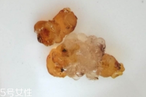 桃膠可以用開水泡嗎？用開水泡桃膠好嗎？