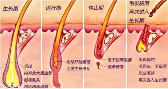 超冰脫毛需要注意什么 超冰脫毛的優(yōu)勢(shì)