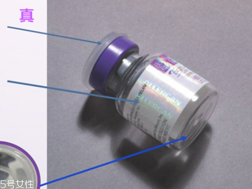 保妥適瘦臉針副作用 教你辨別保妥適瘦臉針真假