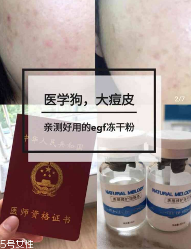 凍干粉使用多久有效果 每個(gè)人的使用情況不一樣