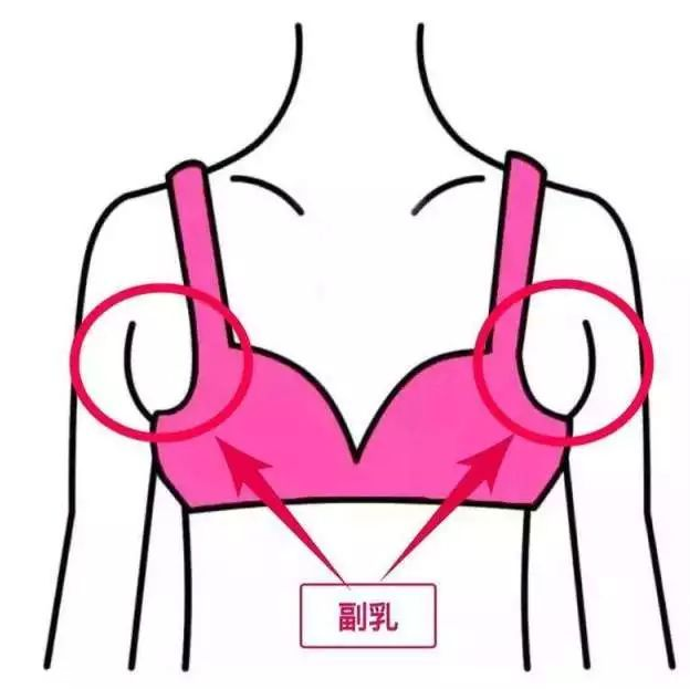 假副乳怎么形成的 3個不良習(xí)慣