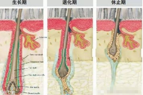 哪些人不適合植發(fā) 這些人群不適合植發(fā)