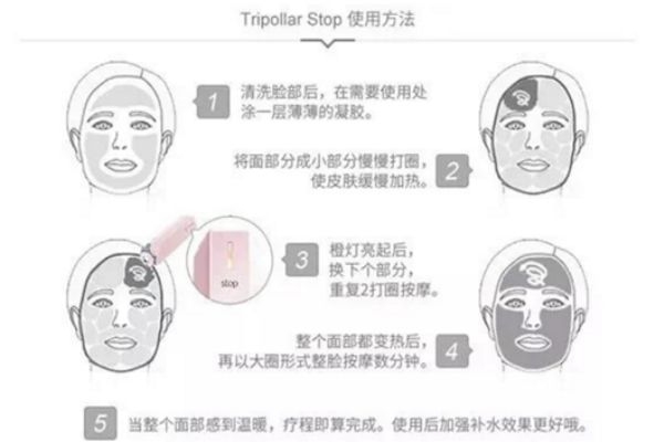 tripollar stop脖子能用嗎 tripollar stop使用時需注意