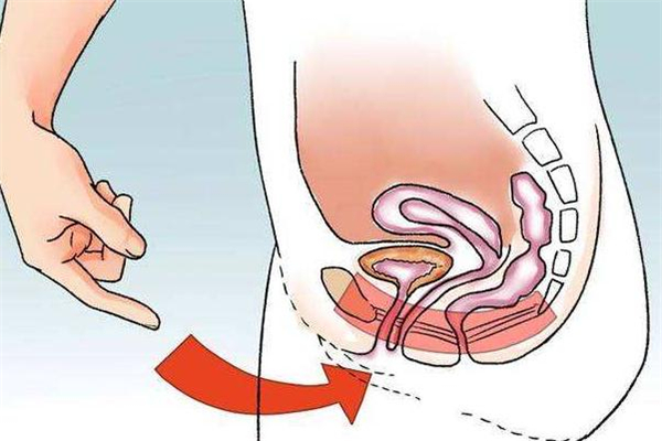 產(chǎn)后盆底肌修復最佳時間 產(chǎn)后盆底肌怎么修復