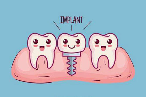 種植牙齒的壽命有多長(zhǎng) 種植牙齒多久能恢復(fù)