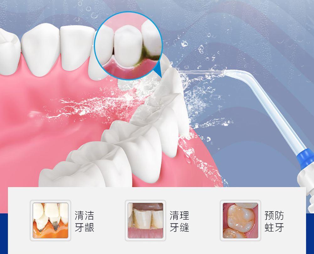 洗牙有哪些壞處呢 洗牙有哪些危害呢