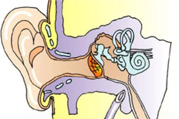中耳炎會(huì)耳鳴嗎 中耳炎會(huì)引起什么癥狀