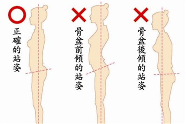 骨盆前傾怎么坐比較好 骨盆前傾要多久才能矯正