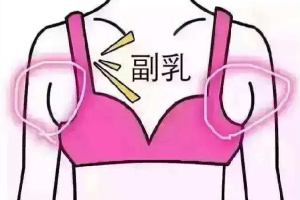 副乳切除手術(shù)會有疤痕嗎 副乳切除手術(shù)怎么才能看不到疤痕