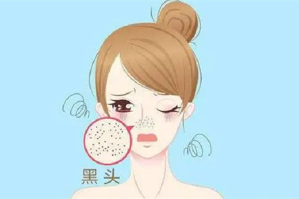 后湖skin79皮膚管理中心去黑頭干凈嗎 黑頭會(huì)自己排出來嗎